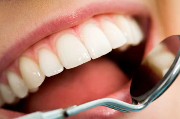 dents blanches